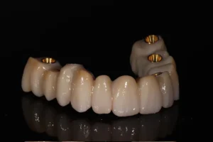 puentes y rehabilitaciones 2