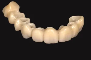 tecnica bopt 4
